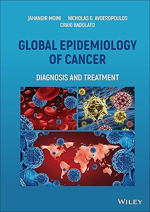 Global Epidemiology of Cancer: Diagnosis and Treatment